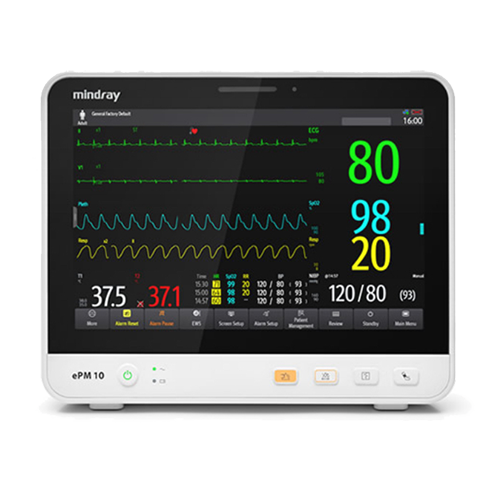 ðŸ©º The Essential Guide to Patient Monitors